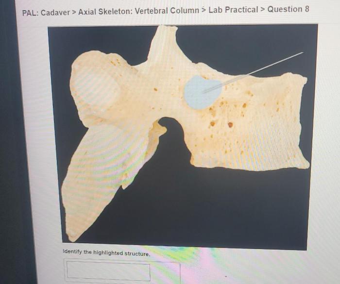 Pal cadaver axial skeleton skull lab practical question 4