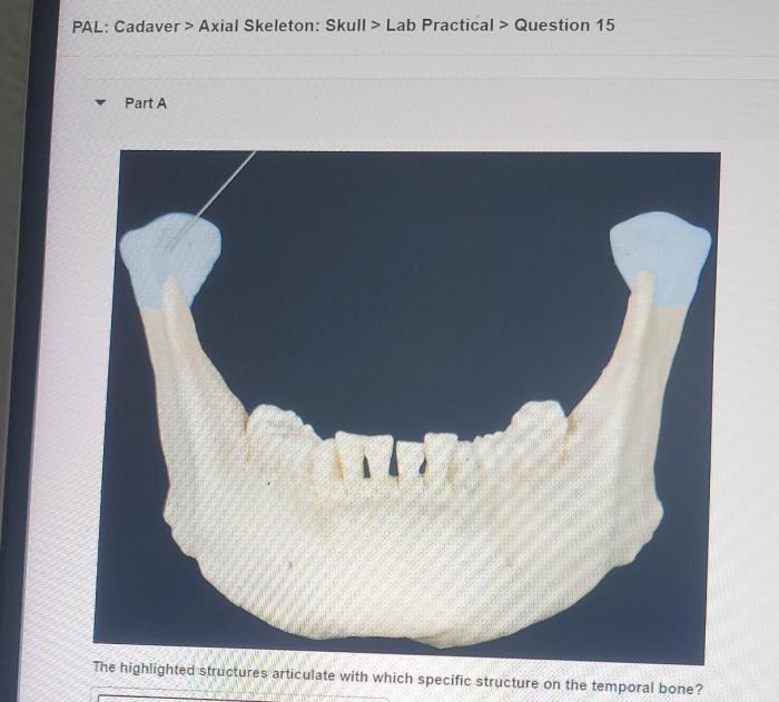 Pal cadaver axial skeleton skull lab practical question 4